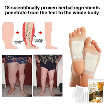 Bee Venom Lymphatic Drainage & Sliming Patches
